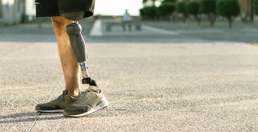 Physical Limitations Can Hurt Your Business